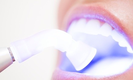 Up to 85% Off on Dental Checkup (Cleaning, X-Ray, Exam) at Matsui Dental