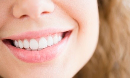 $1,000 or $2,500 Credit Towards Dental Implant Packages at Hallmark Dental
