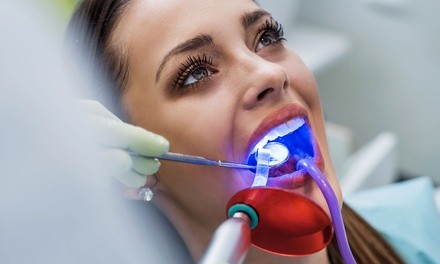 Dental Exam and Cleaning Package or Laser Teeth Whitening at Marino Family Dental (Up to 64% Off). Two Options.