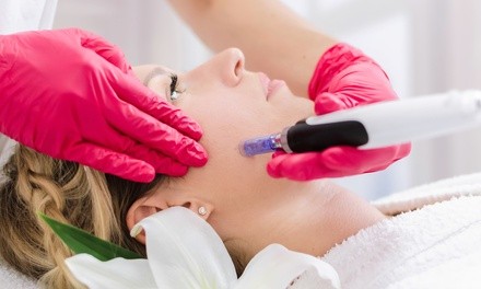 One or Two Microneedling Treatments with PRP Facial at MD Concierge (Up to 61% Off)