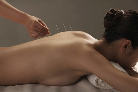 Up to 50% Off on Acupuncture Services at Oriental Acupuncture Wellness Center