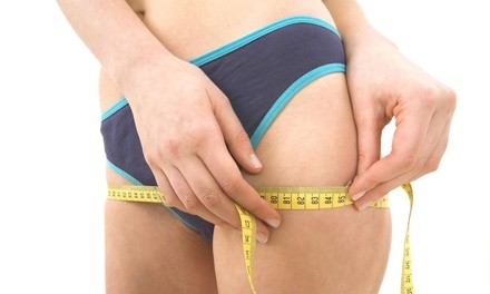 $138 for $250 Worth of Ultrasonic Fat Reduction — North Jersey Nutrition