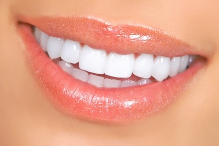 Up to 56% Off on Teeth Whitening - In-Office - Branded (Beyond, Power) at Brows by Ami
