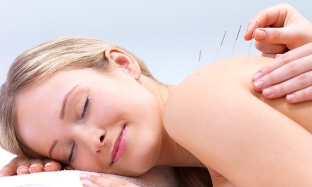 One-Time Standard, Signature, or Deluxe Acupuncture Session Package at Libery Health (Up to 53% Off)