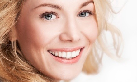 Up to 73% Off on Micro-Needling at The Med Spa Chandler