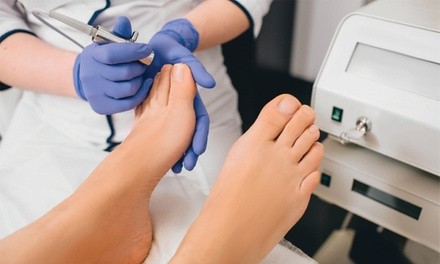 Up to 49% Off on Toe Fungus Treatment at Elite Laser Therapy of Northern Nevada