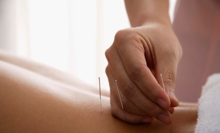 Up to 46% Off on Acupuncture Services at Acupuncture By The Sea, Melissa Kallsen, LAc