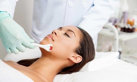 One Microneedling Treatment with Optional PRP Facial at Ellehomme Holistic Med Spa (Up to 80% Off)