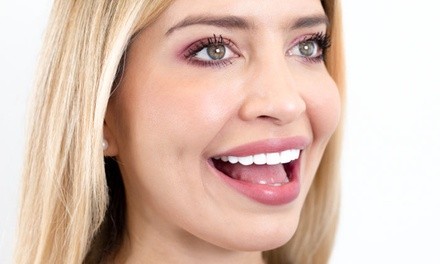 $4,799.20 for Resin Veneers One Arch Up to Ten Teeth at JativaMD ($9,999 Value)