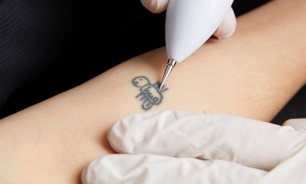 Six Tattoo-Removal Sessions for up to One or Two Square Inches at Sister Lashes (Up to 68%)