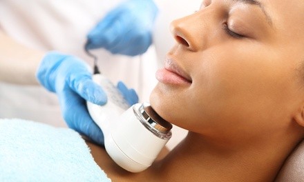 Chemical Peels or Microdermabrasions at Clinical Aesthetics of Atlanta (Up to 73% Off). Two Options Available.