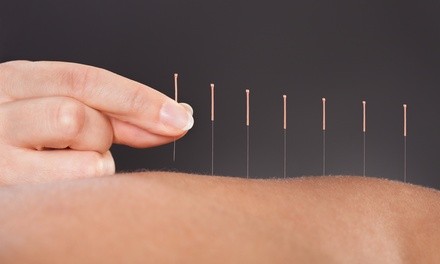 Acupuncture Treatment with Optional Cupping or Massage, or Facial Acupuncture at Acu Health Care (Up to 60% Off)