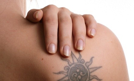 Three Tattoo-Removal Sessions for an Area Up to 2