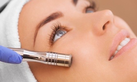 One or Three Diamond Microdermabrasion Sessions at Bellissima Advanced Skincare (Up to 44% Off)