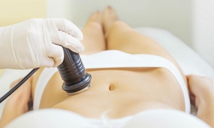 One or Four Ultrasonic Cavitation Contouring Treatments for Abs at Facelift Med Spa (Up to 68% Off)