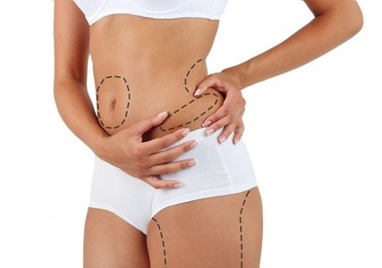 Up to 76% Off on Cavitation at Fifty Shades Of White