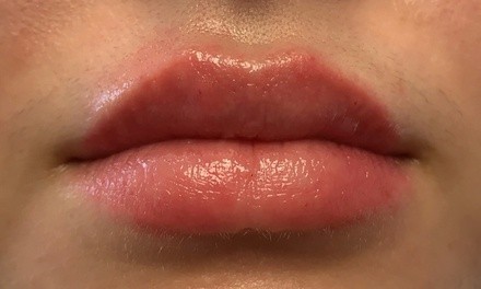 No-Needle Hyaluron Pen Lip Filler at Kyana's Makeup Artistry (Up to 35% Off). Three Options Available.