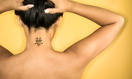 Four Treatments for an Area of Up to 2, 4, 6, or 8 Square Inches at Erased Laser Tattoo Removal (Up to 82% Off)