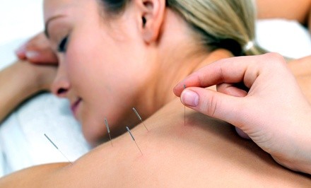 Up to 59% Off on Acupuncture Services at DRIVEN WELLNESS