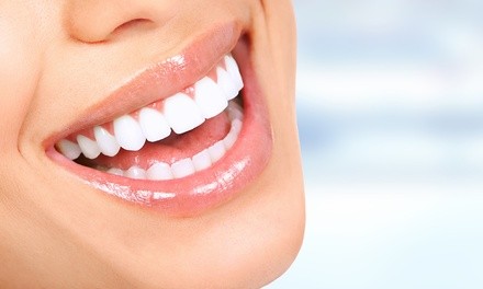 One 40-60- Minute In-Office Cosmetic Teeth Whitening session at Sparkle Teeth Whitening ​(Up to56%￼ Off