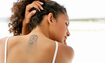 Three Tattoo Removal Sessions on an Area Up to 2x2, 3x3, or 4x4 Inches at Laser by Nicole (Up to 44% Off)