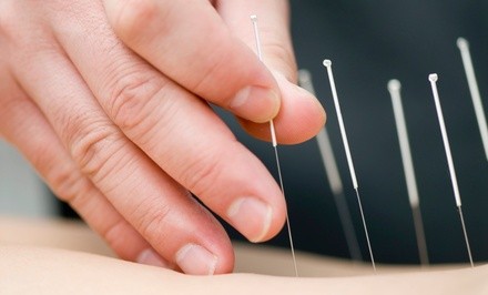 Up to 64% Off on Acupuncture Services at Beati Acupuncture Wellness Clinic