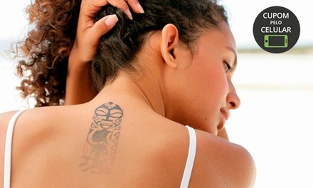 Up to 50% Off on Tattoo Removal at Angel Lashes, Laser & MedSpa