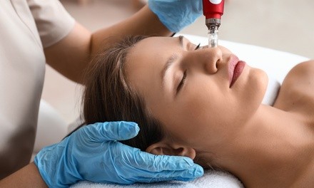 One or Three Microneedling Treatments at Houston Regenerative Center (Up to 77% Off)