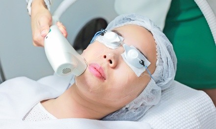 One or Two IPL Photofacials for the Face or Chest at Embodiment MedSpa (Up to 73% Off)