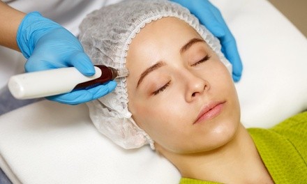 Microneedling Treatment with Optional PRP at Youthology Medical Aesthetics (Up to 36% Off). 4 Options Available.