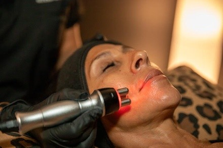 One, Two, or Four Therma-Lift Skin Tightening Facelifts at The Beauty Hut Face & Body Sculpting (Up to 88% Off)