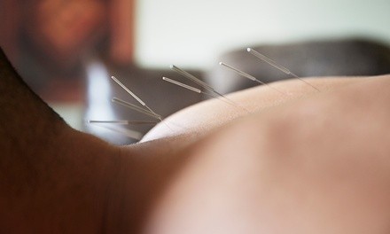 One 45–60-Minute Acupuncture Treatments with Initial Consultation at Acupuncture (Up to 67% Off)