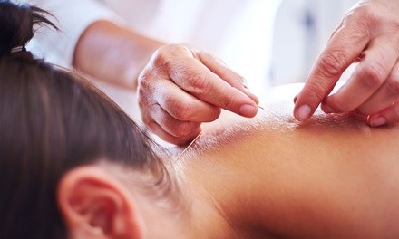 $22 for One 45-Minute Acupuncture Session at Dallas Acupuncture Clinic ($65 Value)