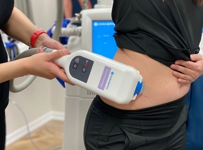 One or Two CoolSculpting Cycles with Optional Botox at Allure Medspa (Up to 51% Off)