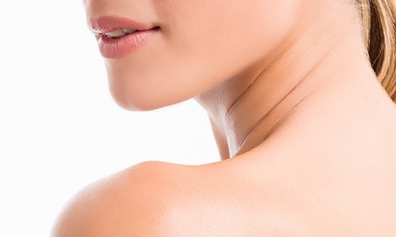 Two Vials of Kybella for Under Chin Reduction Treatment at Allure Medspa (42% Off)