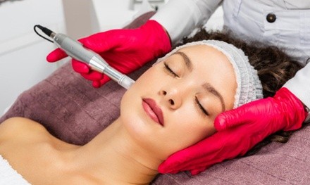 One with Optional Hyaluronic Acid Filler or Three Microneedling Treatments at Broadway SkinCare (Up to 57% Off)