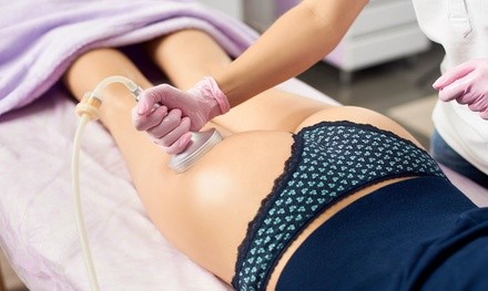 Four or Six Ultrasonic Cavitation Treatments at Colorado Body Sculpting & Rejuvenation Center (Up to 90% Off)