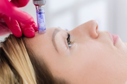 Up to 51% Off on Micro-Needling at Altruistic Health and Wellness