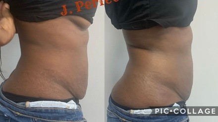 Up to 58% Off on Cavitation at J. Perfected
