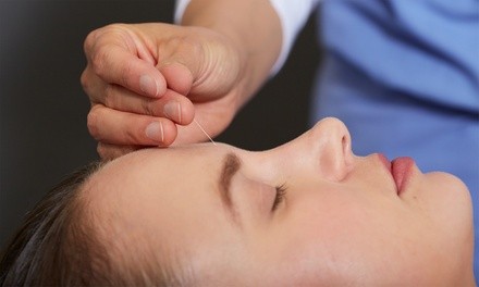 Up to 67% Off on Acupuncture Services at Equilibrium Natural Clinic, LLC