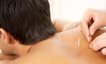 Acupuncture with Nura McCauley, Licensed Acupuncturist and Herbalist (Up to 62% Off). 3 Options Available.