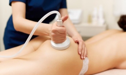 One, Three, or Six Lipo-Cavitation Treatments at Get Sculpted LA (Up to 34% Off). Six Options Available.