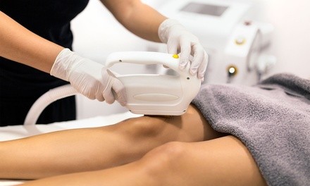 Six Laser Hair Removal Sessions for One Small, Medium, or Large Area at Magma Aesthetics MD (Up to 88% Off)