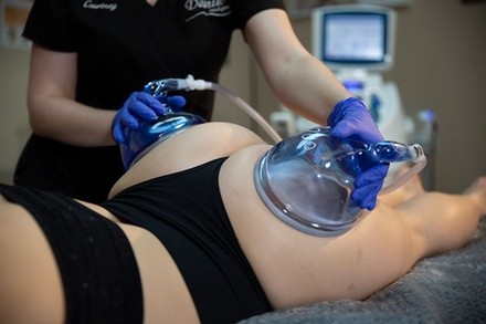 Up to 32% Off on Gluteoplasty / Butt Lift - Non-Surgical at ShapedLV