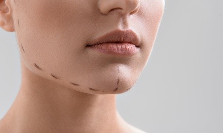 Deoxycholic Acid Double-Chin Treatment at Skinovatio Medical Spa (Up to 76% Off). Three Options Available.