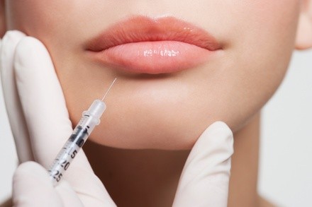 One or Two Syringes of Restylane Filllers (Up to 37% Off)
