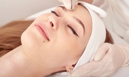 $50 for 60-Minute Diamond Microdermabrasion with Greer at Browtiful Threading & Beauty ($100 Value)