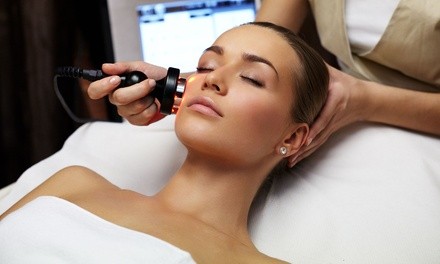 Up to 70% Off on IPL Photo Facial at Bliss Aesthetics