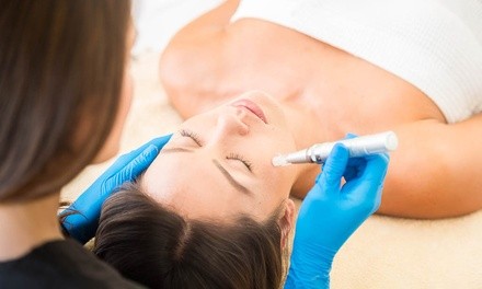 PRP Facial with Skin Bightening, Microneedling, or Both at Revitalize Life Center (Up to 85% Off)