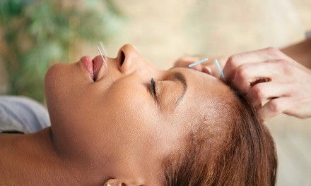 $100 for $150 Worth of Acupuncture — Dr. Xiaoling Fang L.Ac.